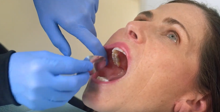 DPS review: Transform Isolation and Retraction with NeoDrys™ Saliva Absorbents